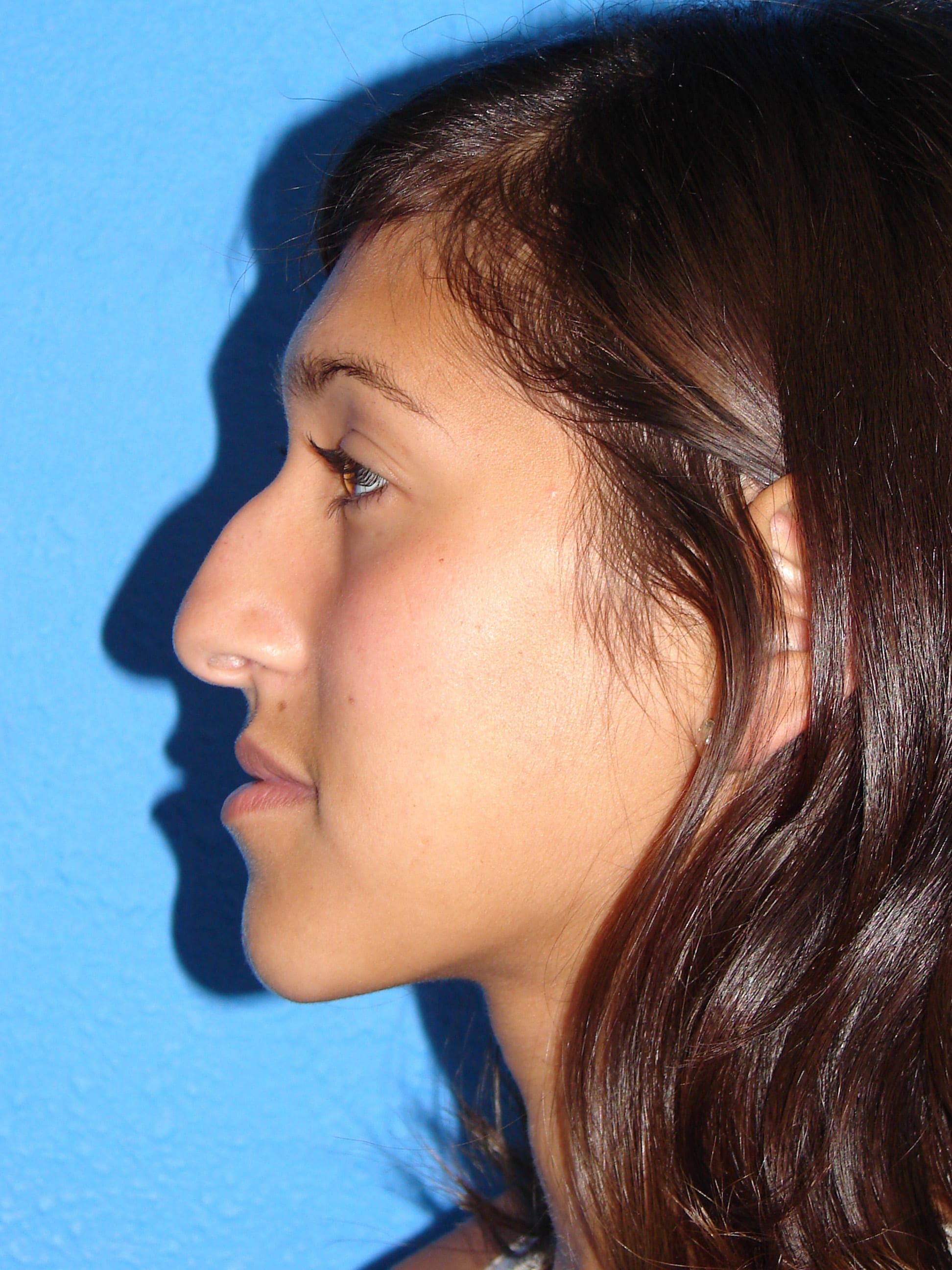 side view nose