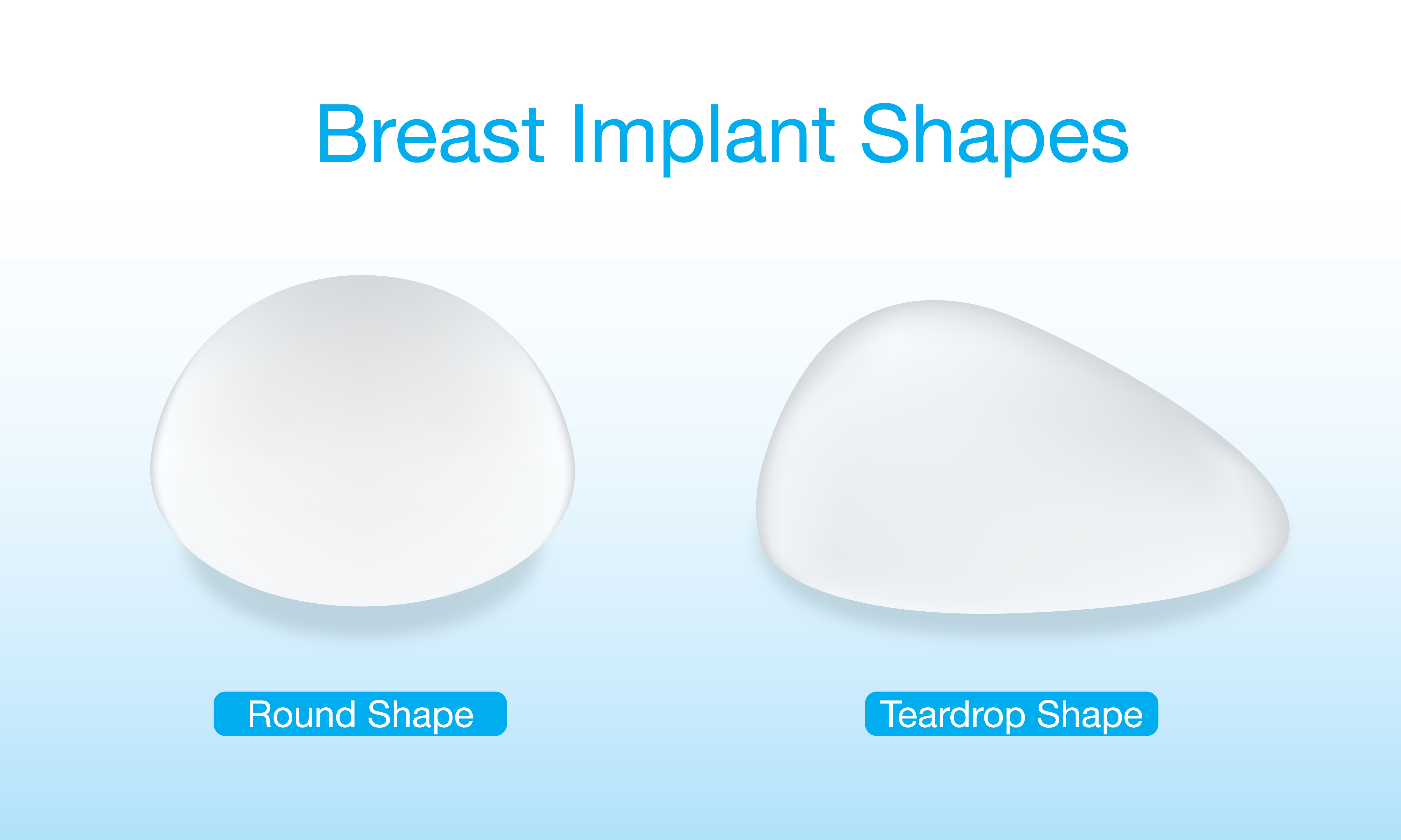 Shaped vs. Round Breast Implants  Birmingham Plastic Surgery Specialists